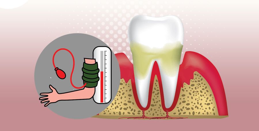 tensiune arteriala in stomatologie - clinica dentara CriniDent