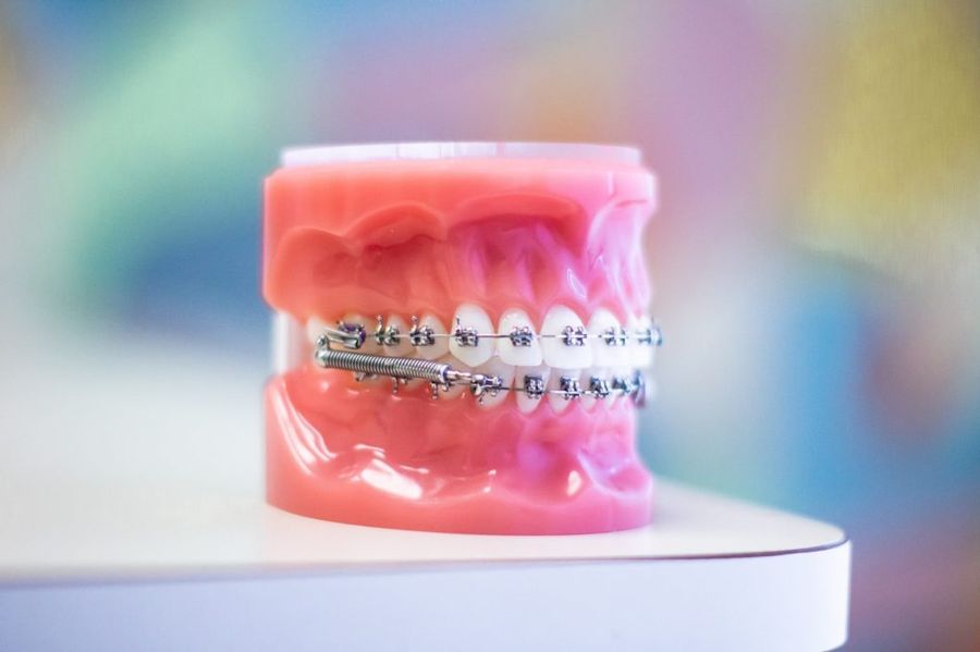 aparate dentare Craiova - ortodontie, dentist Craiova
