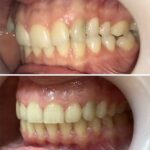 aparate dentare Craiova - ortodontie, dentist Craiova