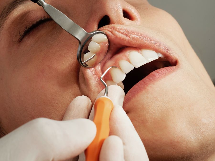 dentist Craiova - stomatologie Craiova, implant dentar, fatete, coroana zirconiu