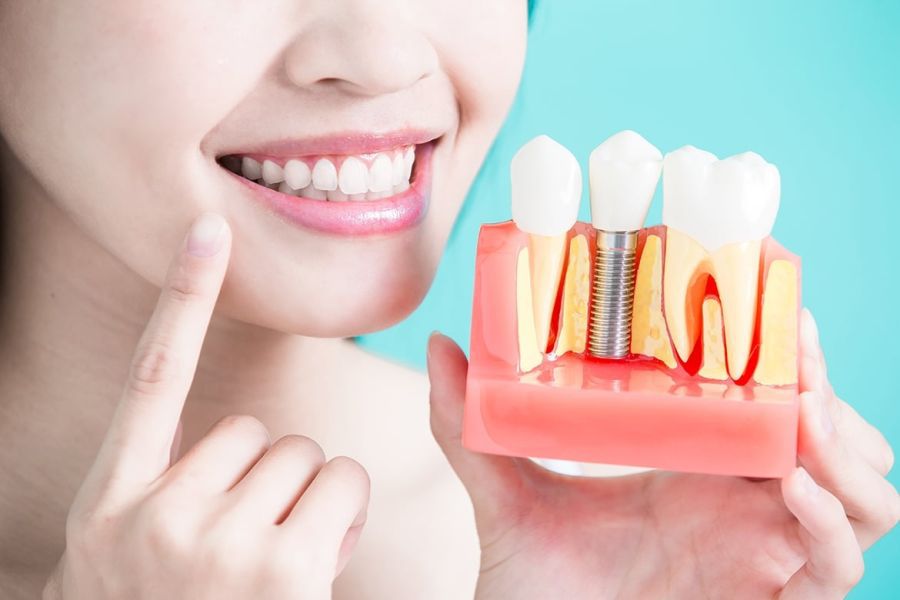 implant dentar pret Craiova - dentist Craiova