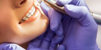 Ce beneficii oferă tratamentul ortodontic cu aparat dentar?